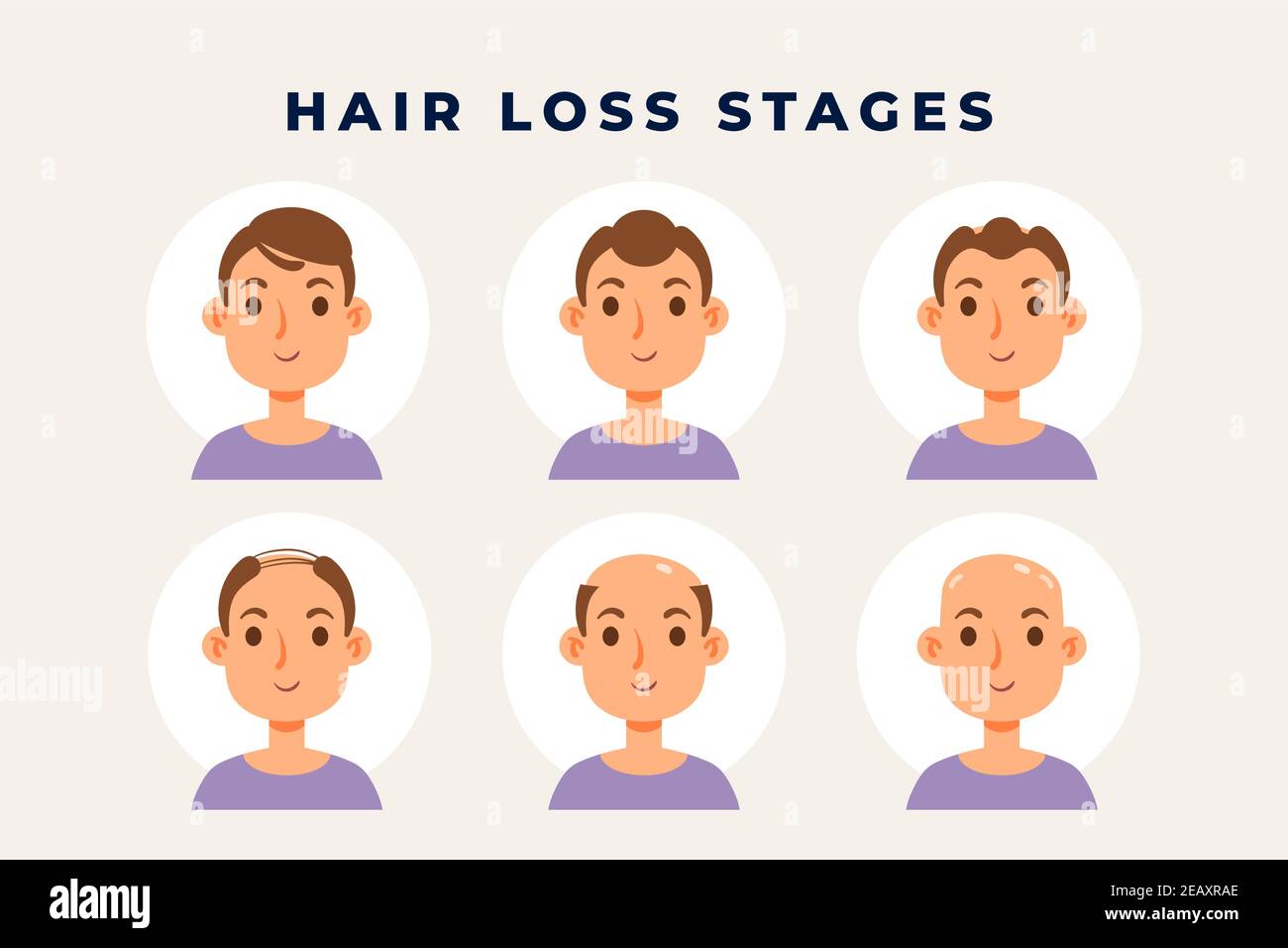Schéma de perte de cheveux en dégradé illustration vectorielle. Illustration de Vecteur