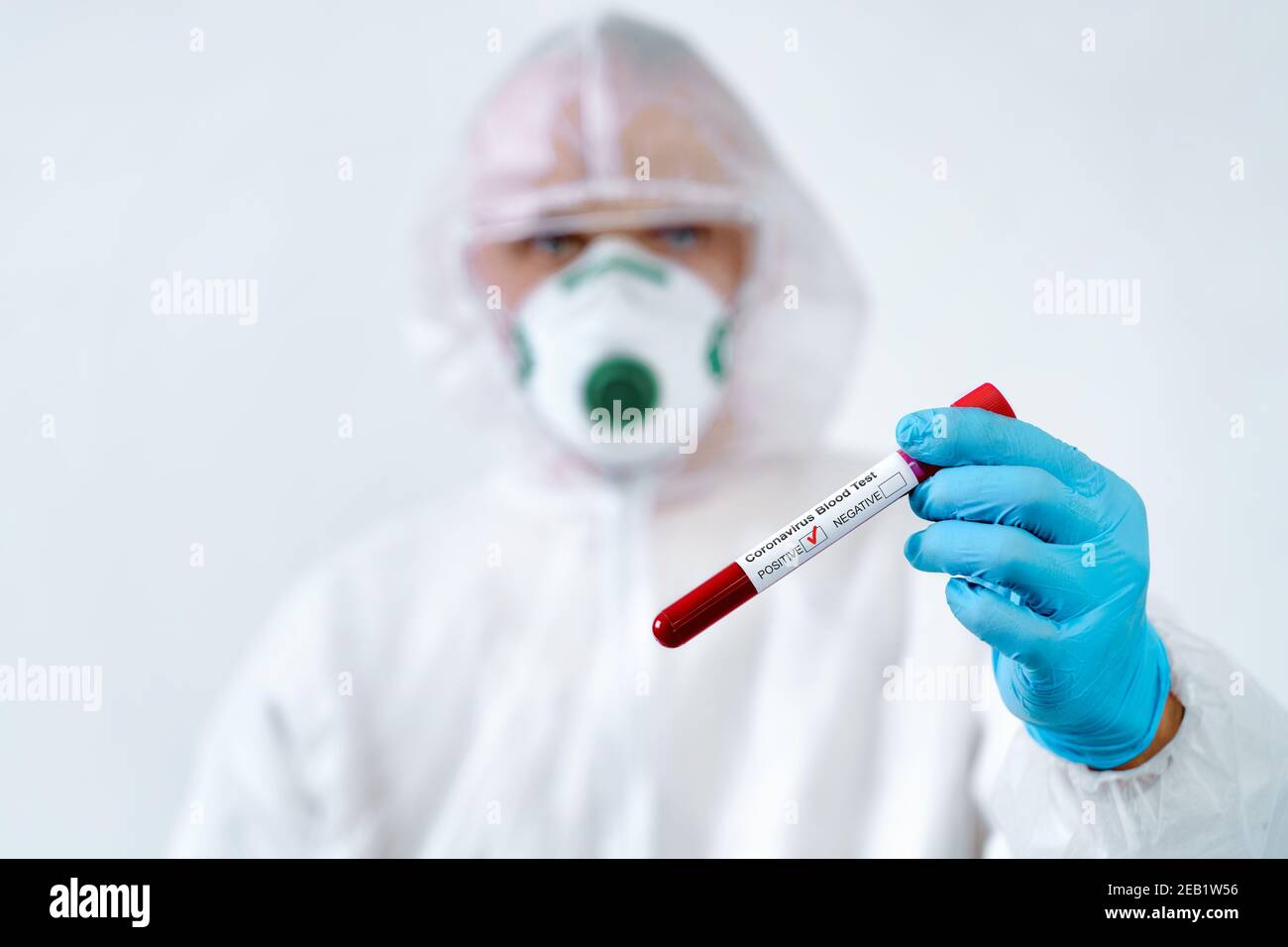 Test positif COVID-19. Le virologue dans un masque médical et une combinaison de protection tient un tube à essai avec un échantillon de sang positif Banque D'Images