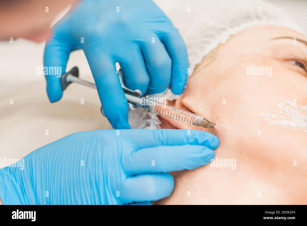 Chirurgie cosmétique sur la peau du visage - intramusculaire injection d'un mastic sous la peau dans le visage d'une femme âgée Banque D'Images