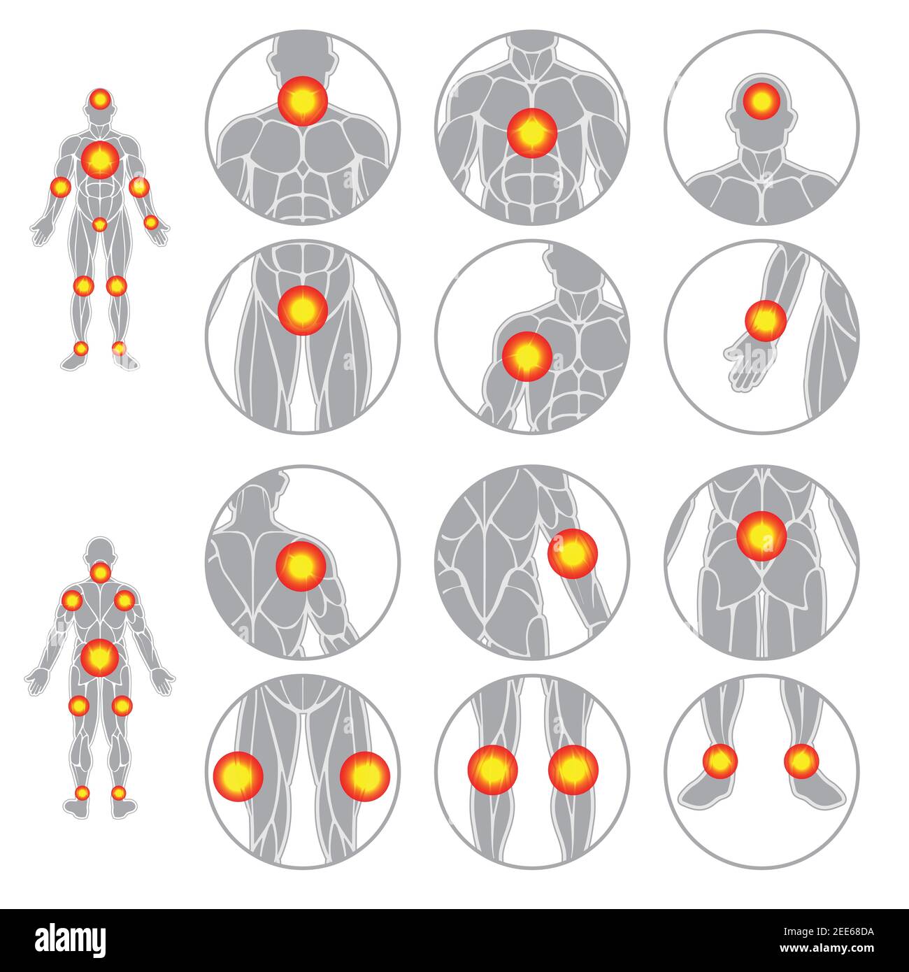 Corps humain points de douleur muscles ensemble Illustration de Vecteur