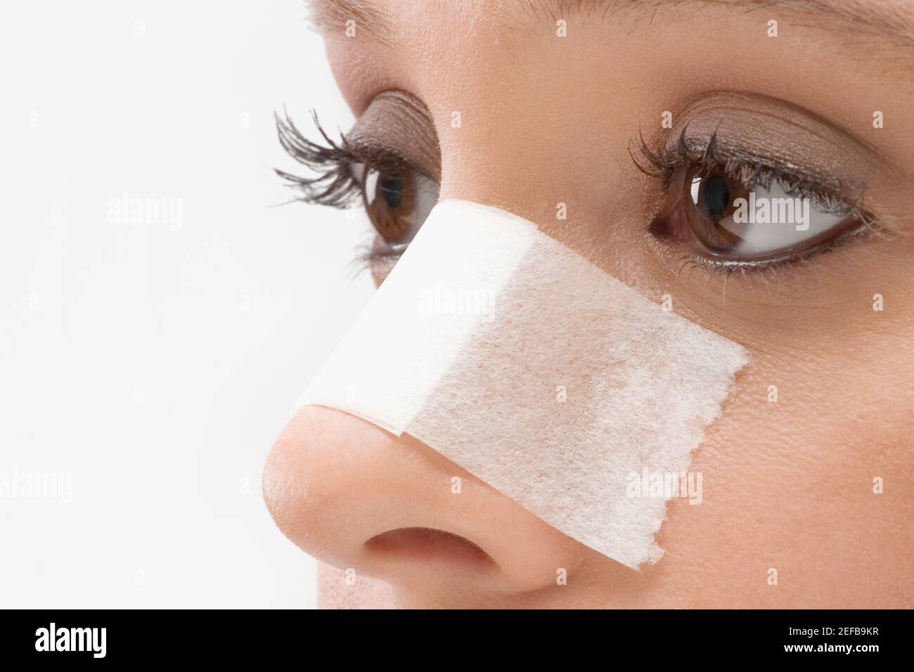 Gros plan d'un bandage adhésif sur un nez patientÅlv Photo Stock - Alamy