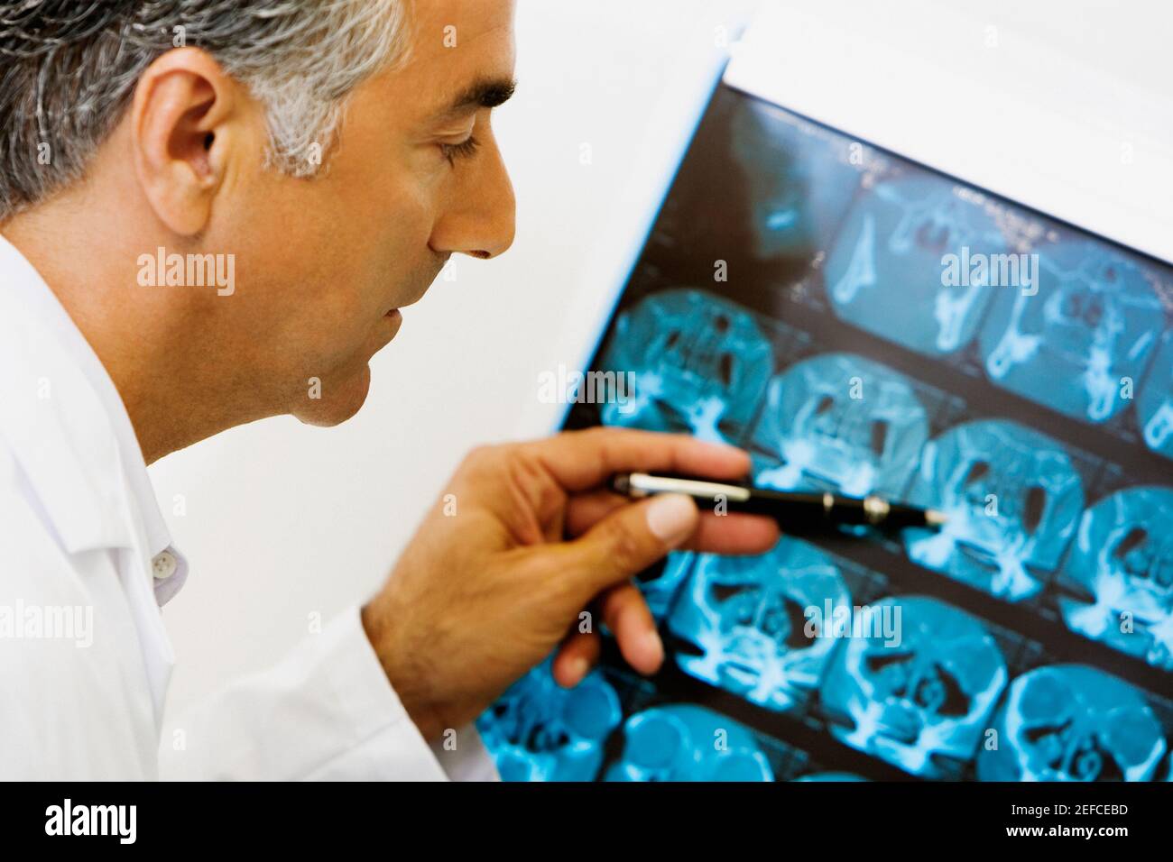 Profil latéral d'un médecin de sexe masculin examinant une radiographie Banque D'Images
