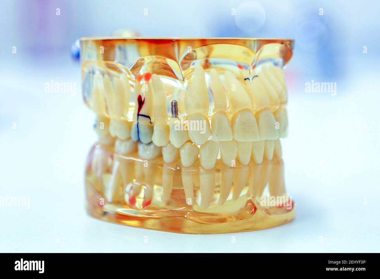 Prothèses dentaires transparentes de l'anatomie des dents humaines Banque D'Images