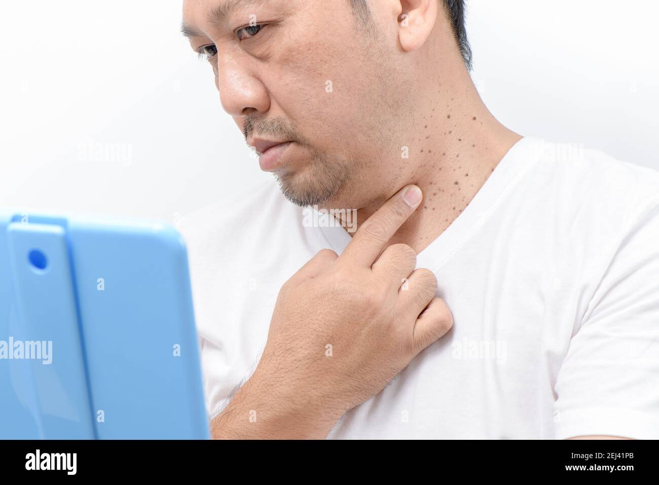 mam d'âge moyen pointe vers la peau Tags ou Acrochordon sur le cou homme sur fond blanc. Concept de soins de santé Banque D'Images