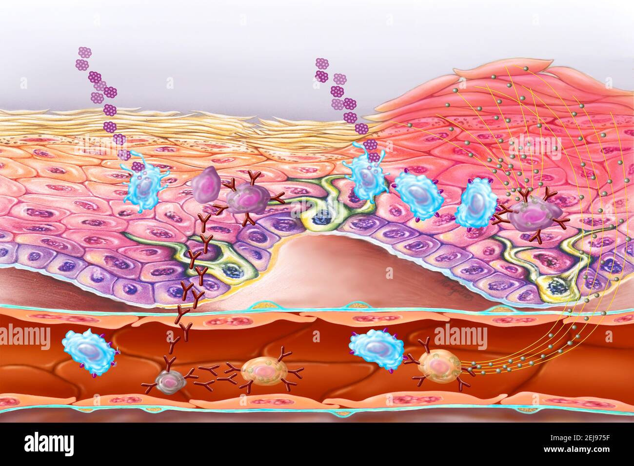 Allergie, dessin Banque D'Images
