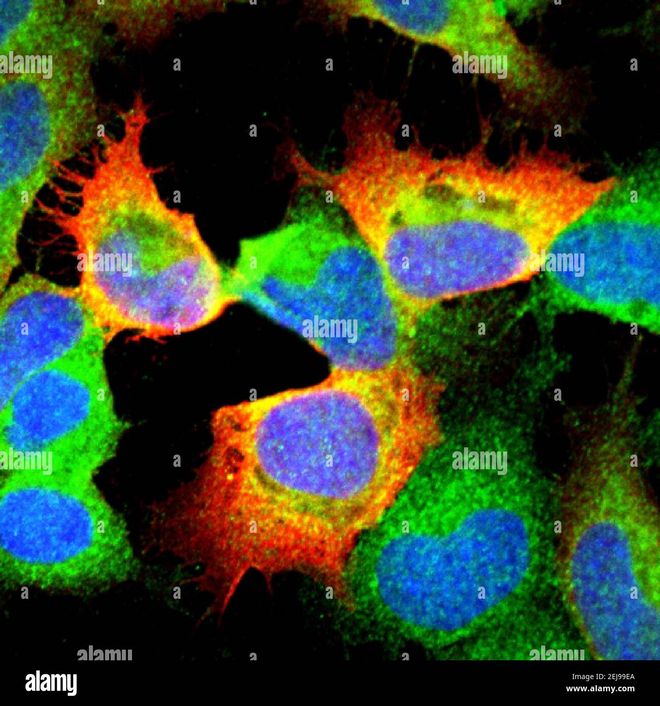 Cellules infectées par le virus langat Banque D'Images