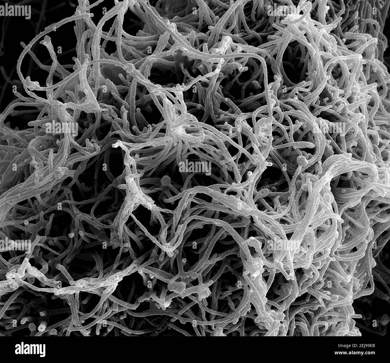 Cellule vero e6 infectée par Ebola Banque D'Images