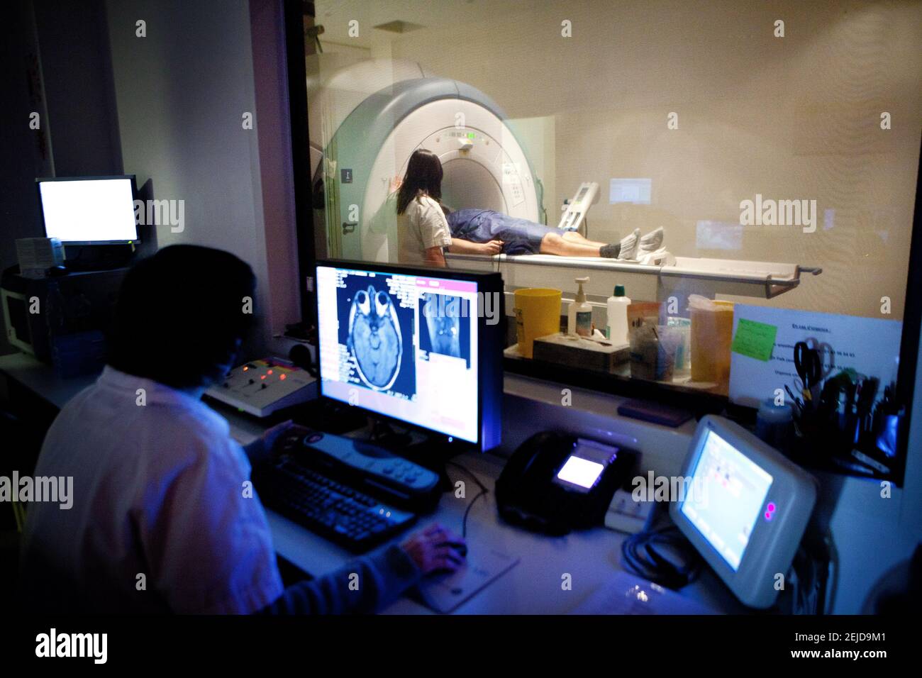 IRM ou imagerie par résonance magnétique de la tête d'un patient. Banque D'Images