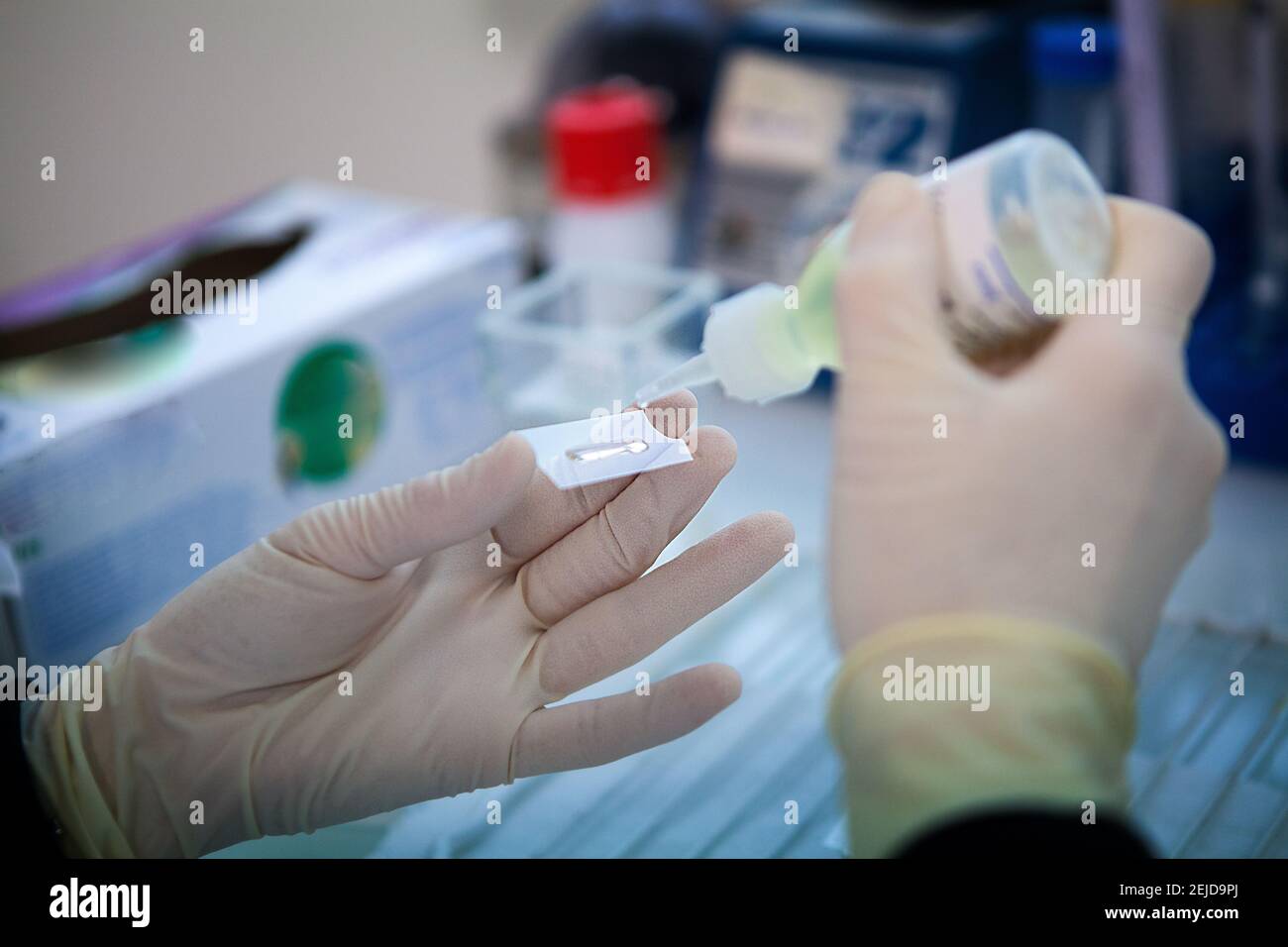 Fabrication de vaccins thérapeutiques pour le traitement du cancer du poumon à petites cellules. Banque D'Images