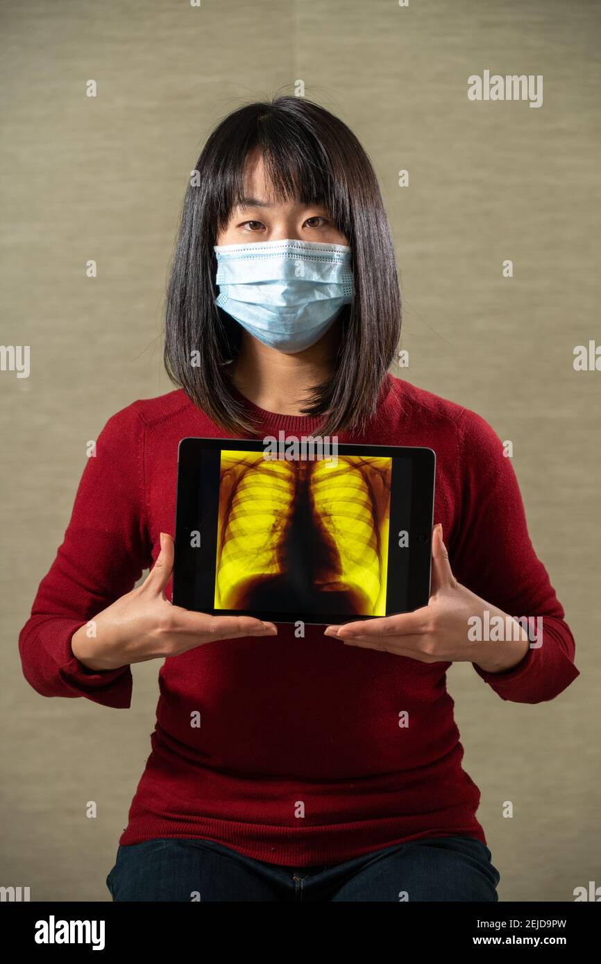 Femme tenant un écran avec une image radio de poumons Banque D'Images