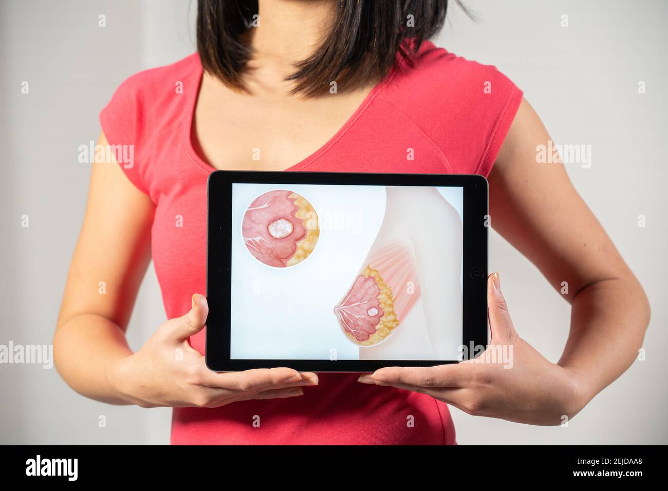 Femme tenant l'écran avec dessin du cancer du sein Banque D'Images