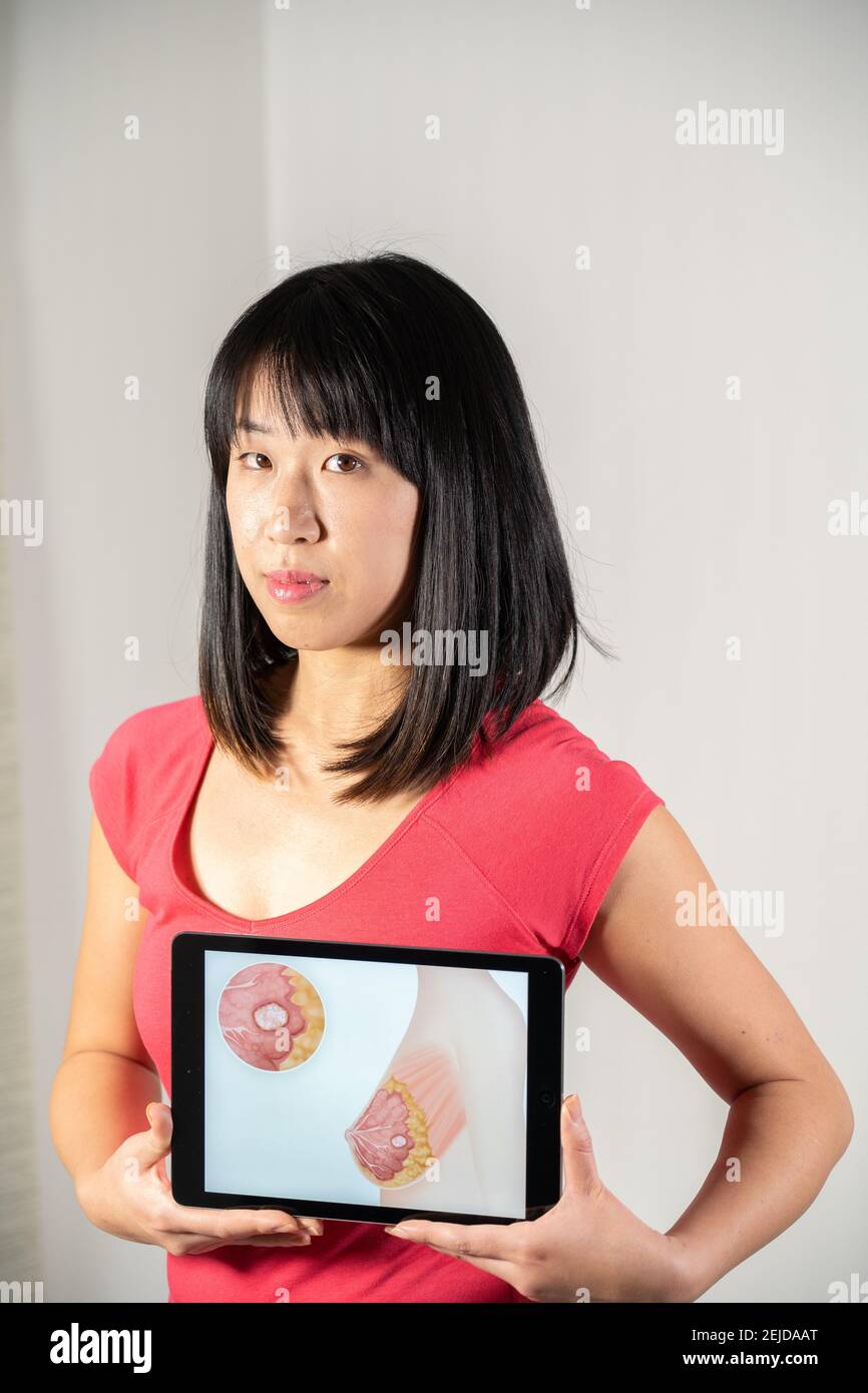 Femme tenant l'écran avec dessin du cancer du sein Banque D'Images
