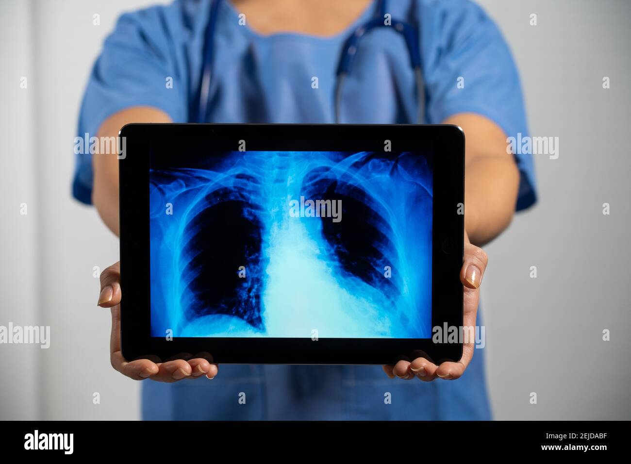 Femme médecin tenant un écran avec rayons X des poumons. Banque D'Images