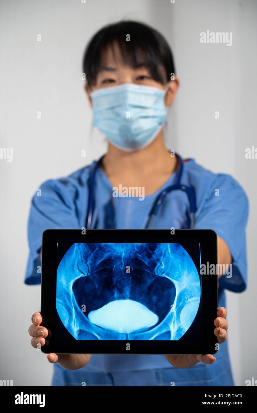 Femme médecin tenant un écran avec une radiographie de la vessie. Banque D'Images