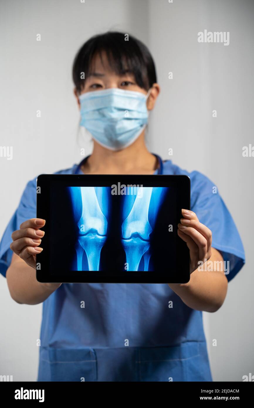 Femme médecin tenant un écran avec rayons X des poumons. Banque D'Images