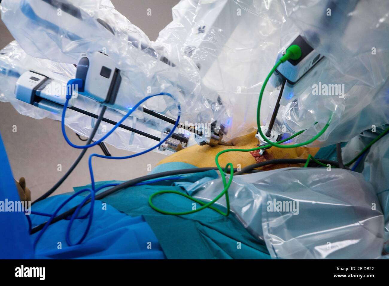Dans la salle d'opération, une hystérectomie avec un robot chirurgical. Banque D'Images