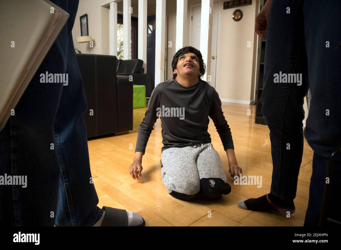 Trisomie 9 Banque D Image Et Photos Alamy