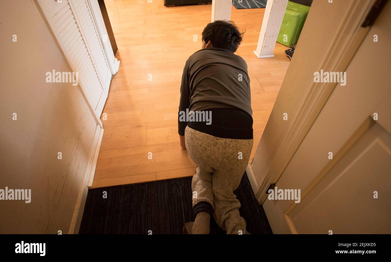 Trisomie 9 Banque D Image Et Photos Alamy Trisomie 9 Banque D Image Et Photos Alamy