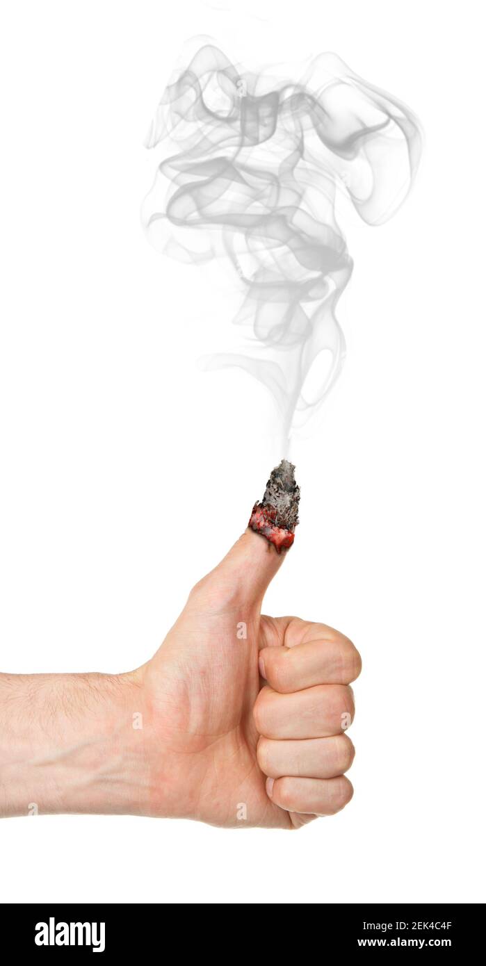 Main d'homme avec le pouce brûlant vers le haut, isolé sur fond blanc Banque D'Images
