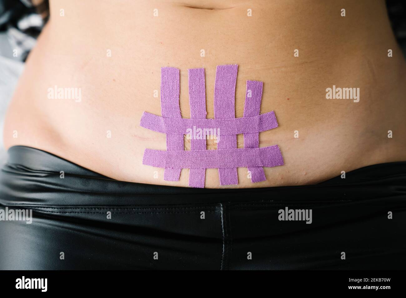 Ruban thérapeutique élastique violet sur l'abdomen de la femme Banque D'Images