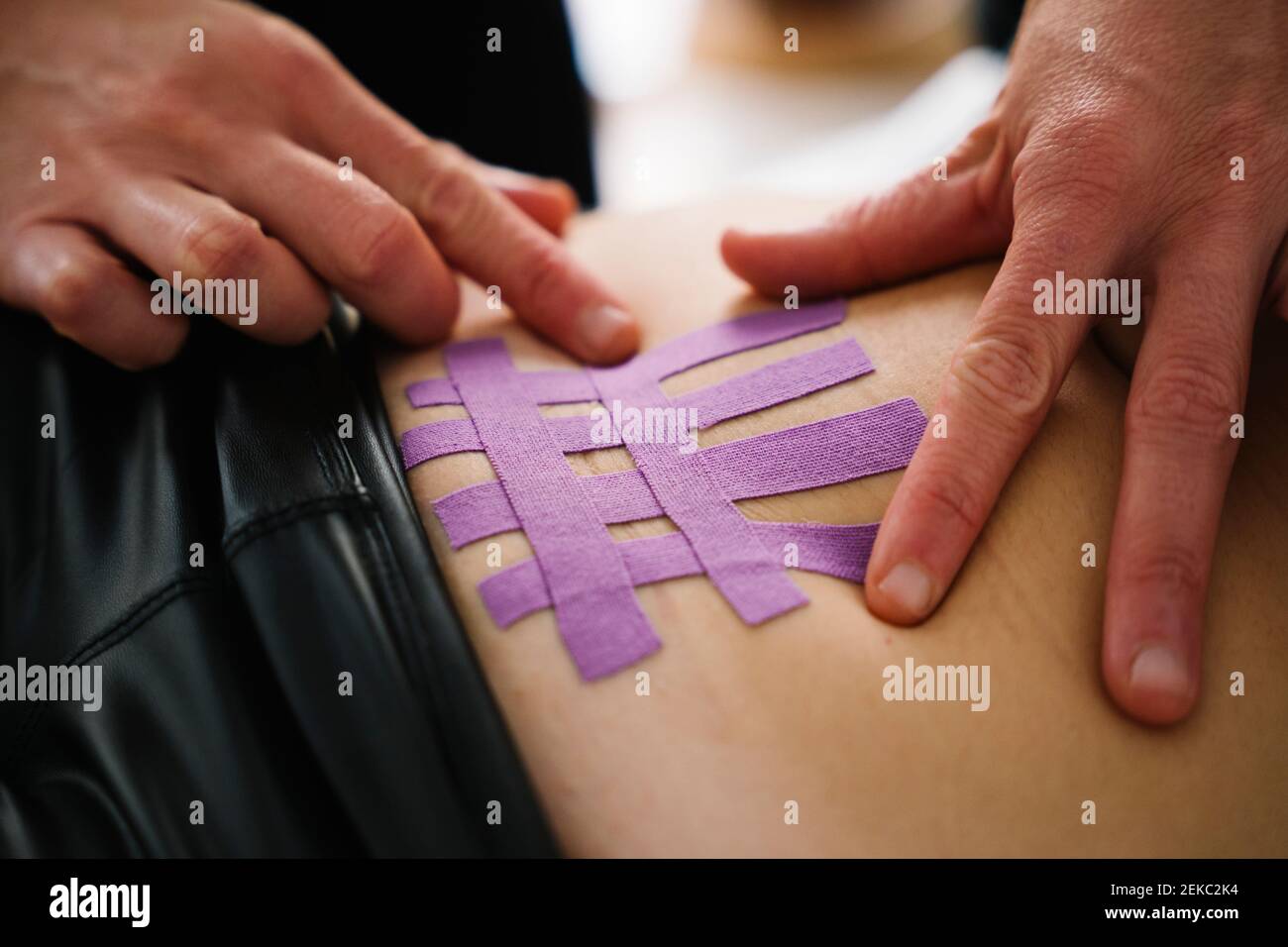 Infirmière féminine appliquant du ruban thérapeutique élastique violet sur l'abdomen de la femme Banque D'Images