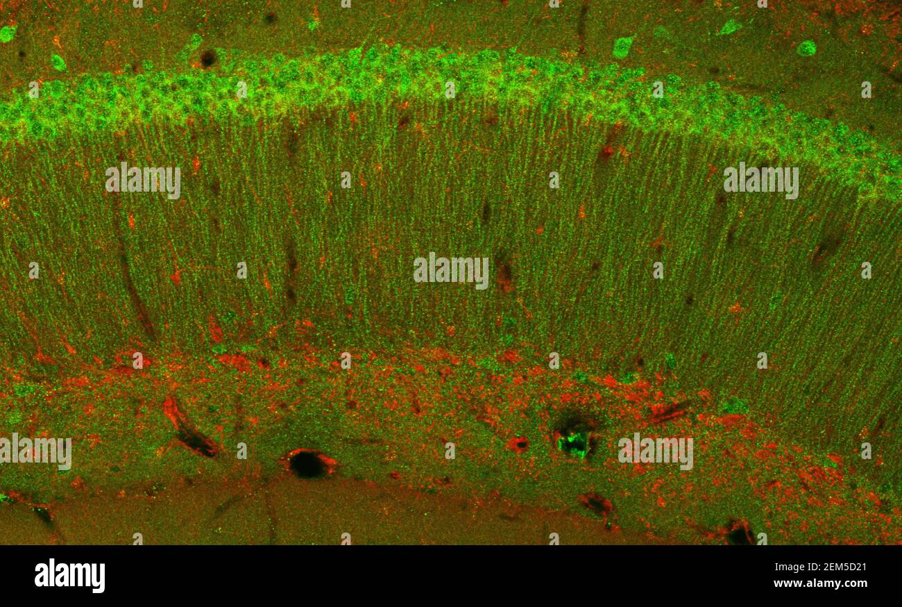 Image confocale au microscope à balayage laser des cellules de l'hippocampe du cerveau de la souris Banque D'Images