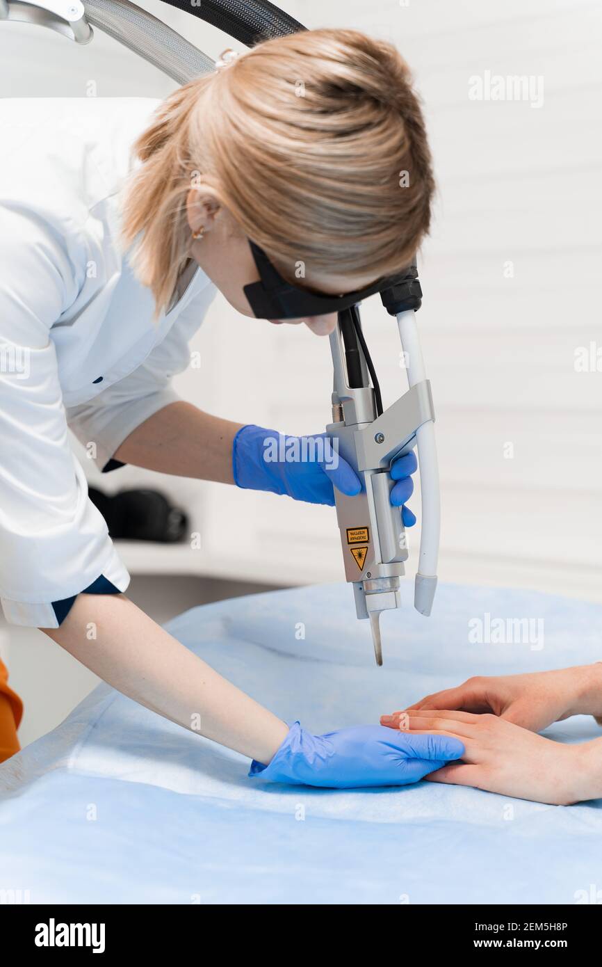 Traitement au laser de l'onychomycose. Infection fongique sur les mains d'une jeune fille en clinique médicale. Banque D'Images