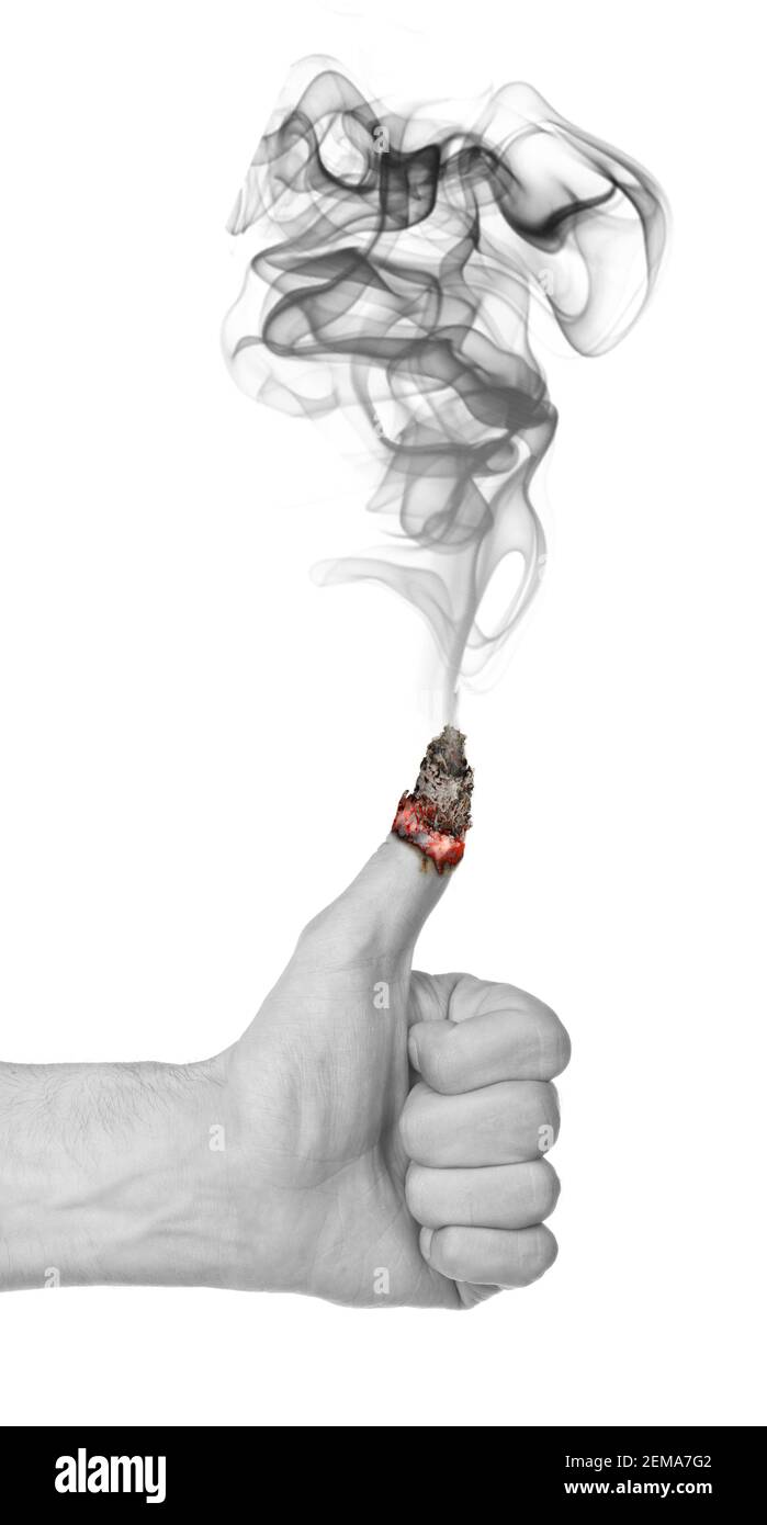 Main d'homme avec le pouce brûlant vers le haut, isolé sur fond blanc Banque D'Images