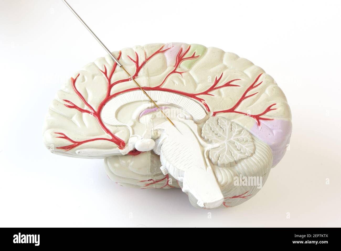 Enregistrement Miicroélectrode sur le modèle cérébral. Concept d'enregistrement du cerveau dans le noyau subthalamique pour la chirurgie de la maladie de Parkinson. Banque D'Images