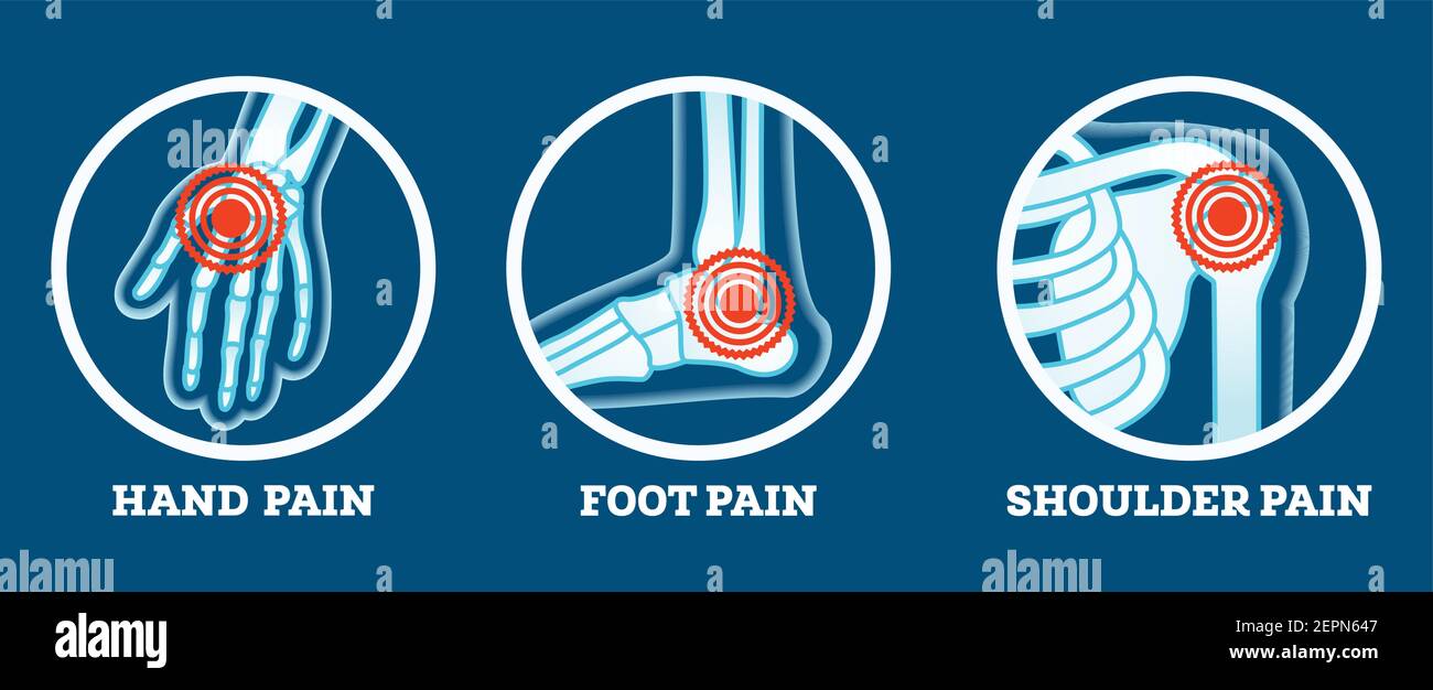 Douleur corporelle. Icônes définies. Douleur dans la main, le pied et l'épaule. Parties du corps pour femme et homme. Illustration vectorielle. Illustration de Vecteur