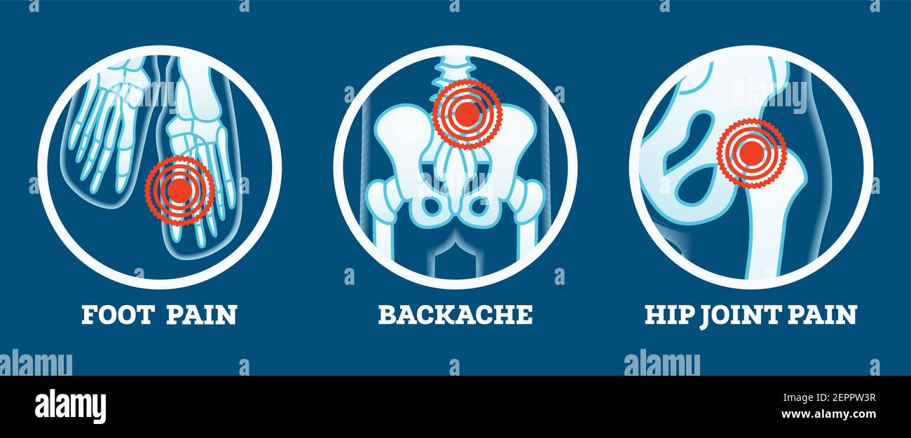 Douleur corporelle. Icônes définies. Douleur au pied, mal de dos et articulation de la hanche. Parties du corps pour femme et homme. Illustration vectorielle. Illustration de Vecteur
