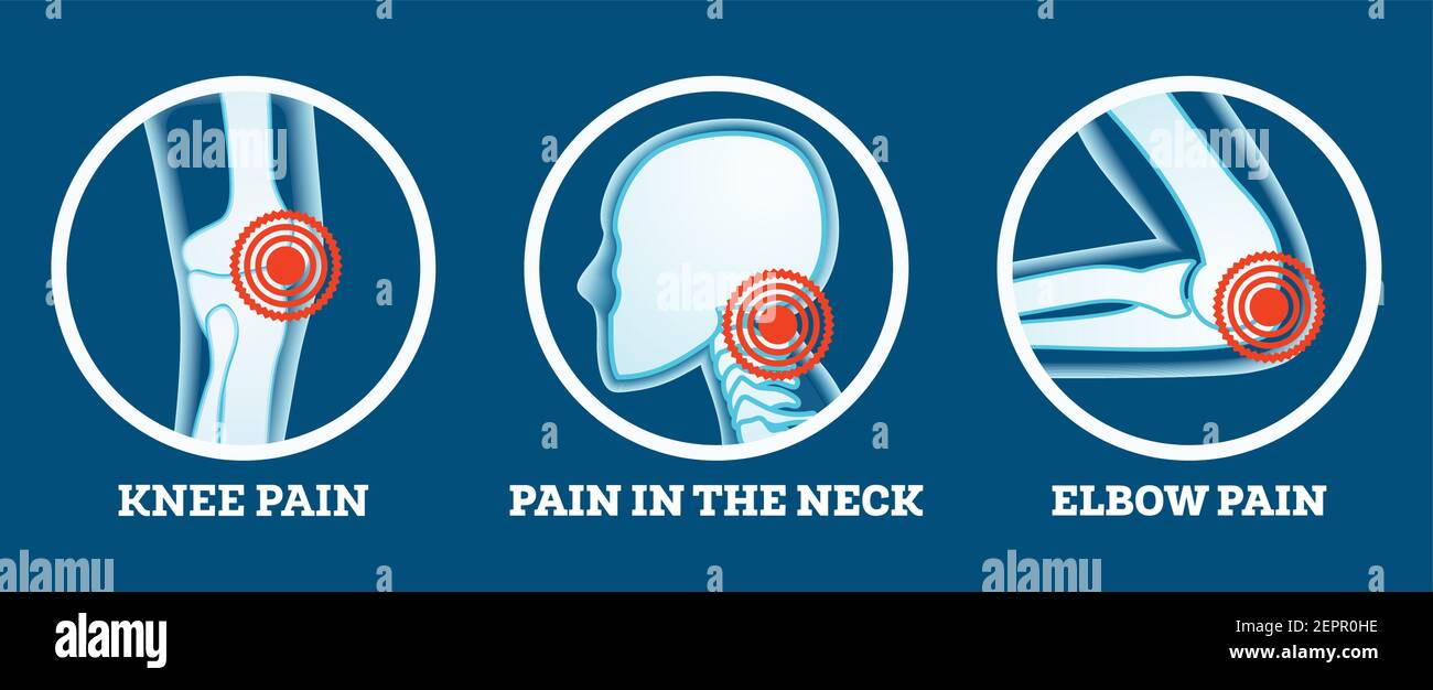 Douleur corporelle. Icônes définies. Douleur au genou, au cou et au coude. Parties du corps pour femme et homme. Illustration vectorielle. Illustration de Vecteur