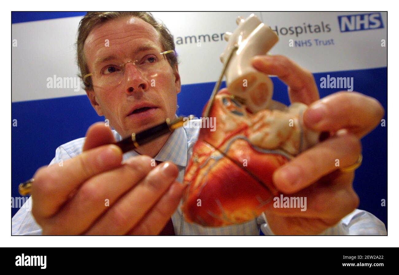 Le prof Nicholas Fisk, prof de l'obstétrique et de la gynécologie a dirigé l'équipe impliquée dans la naissance de jumeaux conjoints à l'hôpital Queen Charlotte & Chelsea Explaines à une conférence de presse comment les filles jumelles partagent un coeur et le foie.pic David Sandison 30/4/2002 Banque D'Images