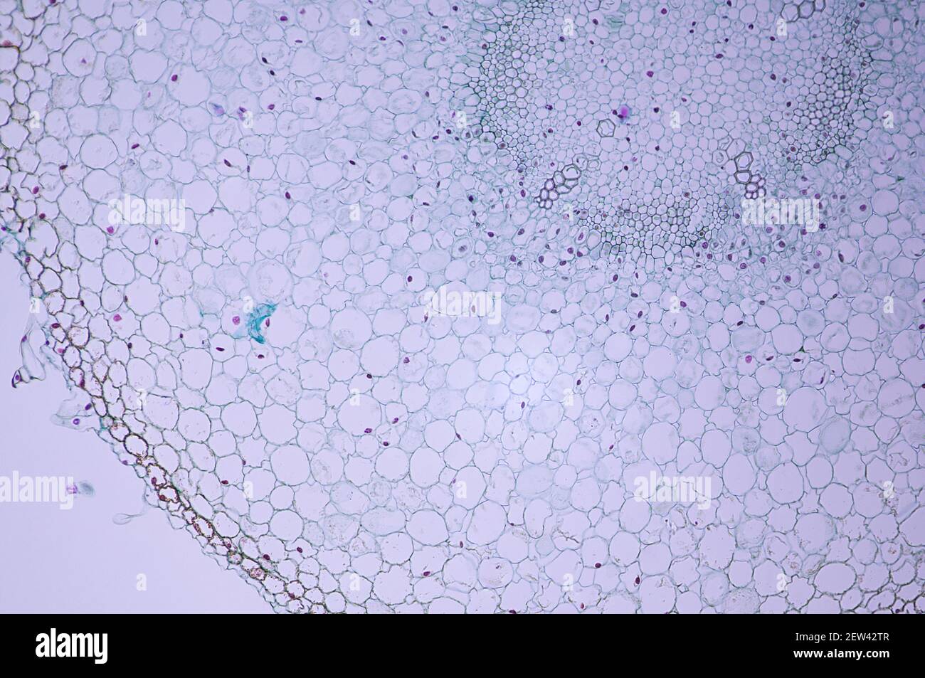 Grossissement de dix fois des cellules radiales sous une lumière microscope Banque D'Images