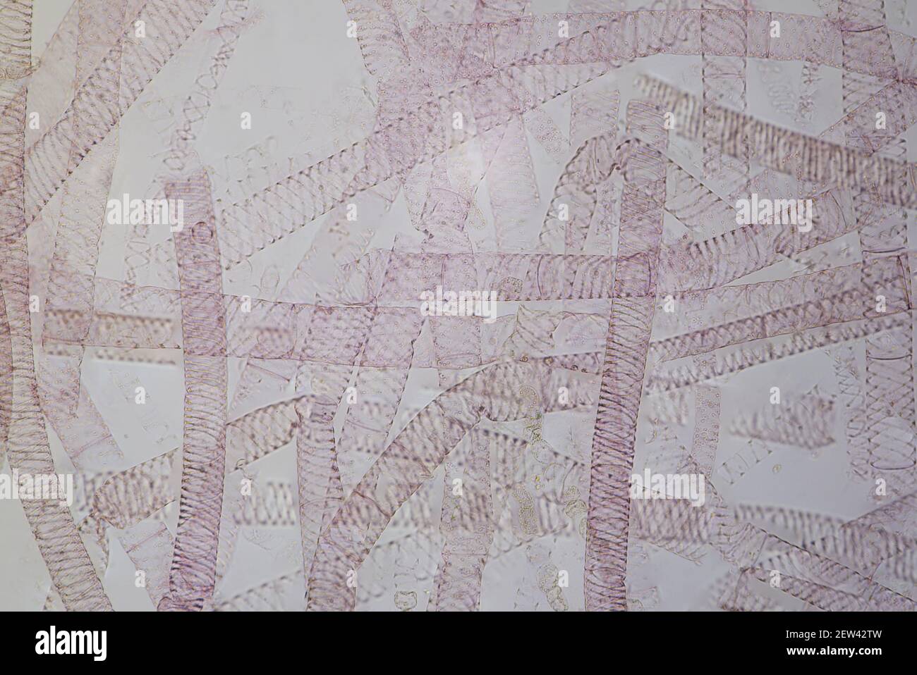 L'arrangement en spirale des chloroplastes est Spirogyra végétative (plastes) sous un microscope léger avec un grossissement de 10 fois Banque D'Images