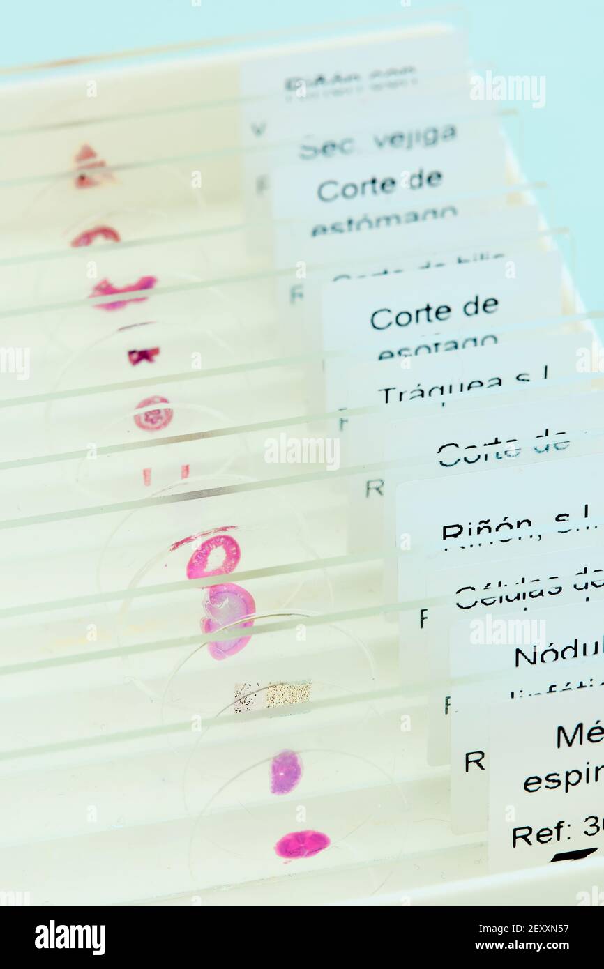 Lames avec échantillons de tissus dans un laboratoire médical. Pays basque, Espagne, Europe. Banque D'Images