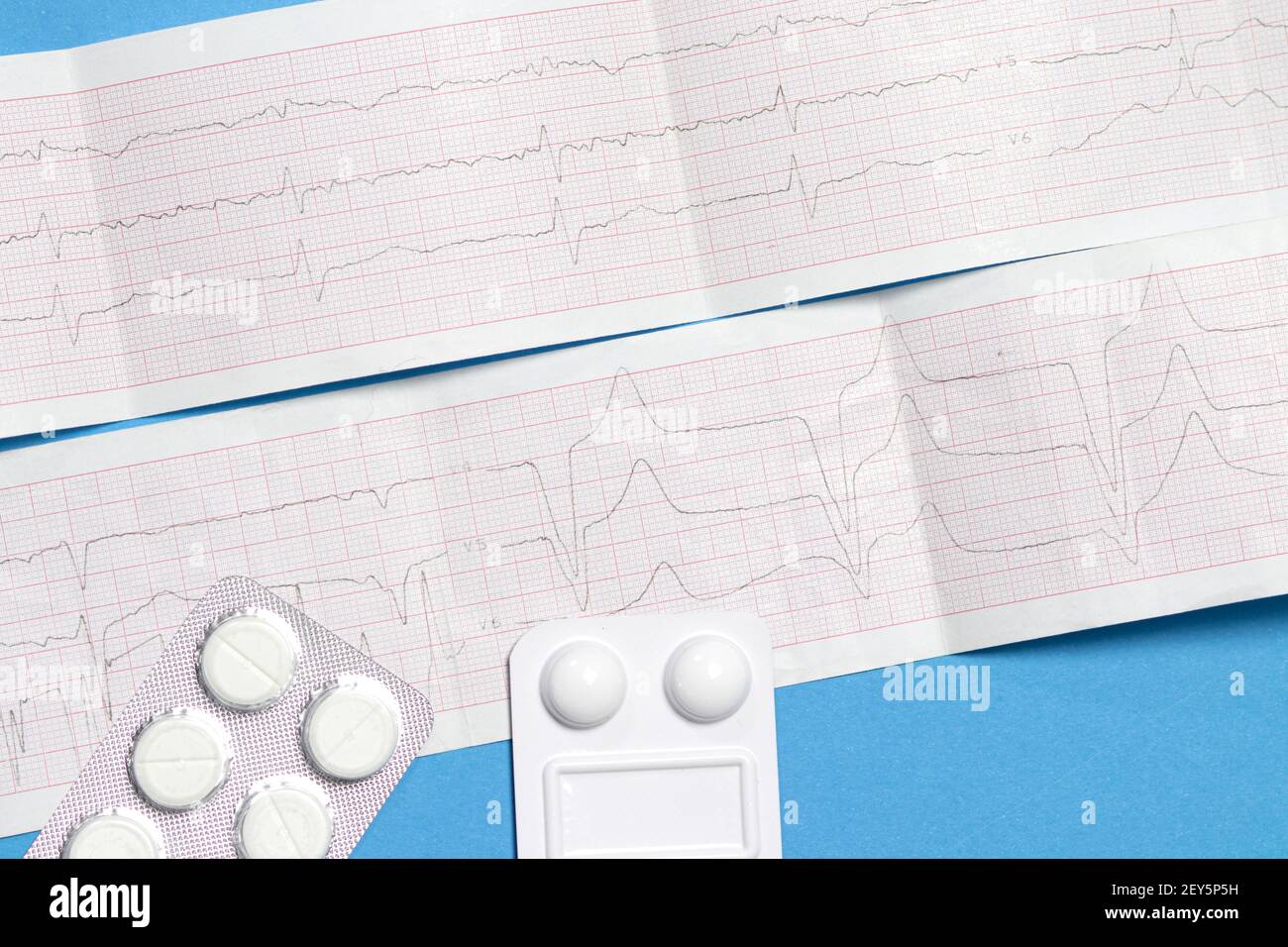 Arythmie cardiaque cardiologie Banque de photographies et d’images à haute résolution Alamy
