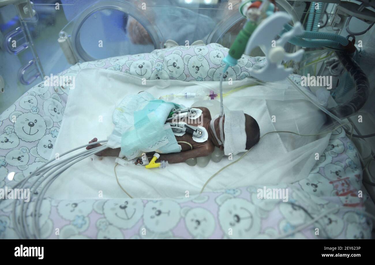 Un Poids De 660 Grammes A La Naissance Prematuree De Bebe Qui A Ete Force A Abandonner Les 23 Semaines Ont Survecu A Chongqing Sichuan Chine Le 18 Novembre 14 La Raison Est L Avortement Hemorragie Massive Qui A Cause Par Le Previa De Un Poids De 660 Grammes A La Naissance Prematuree De Bebe Qui A Ete Force A Abandonner Les 23 Semaines Ont Survecu A Chongqing Sichuan Chine Le 18 Novembre 14 La Raison Est L Avortement Hemorragie Massive Qui A Cause Par Le Previa De