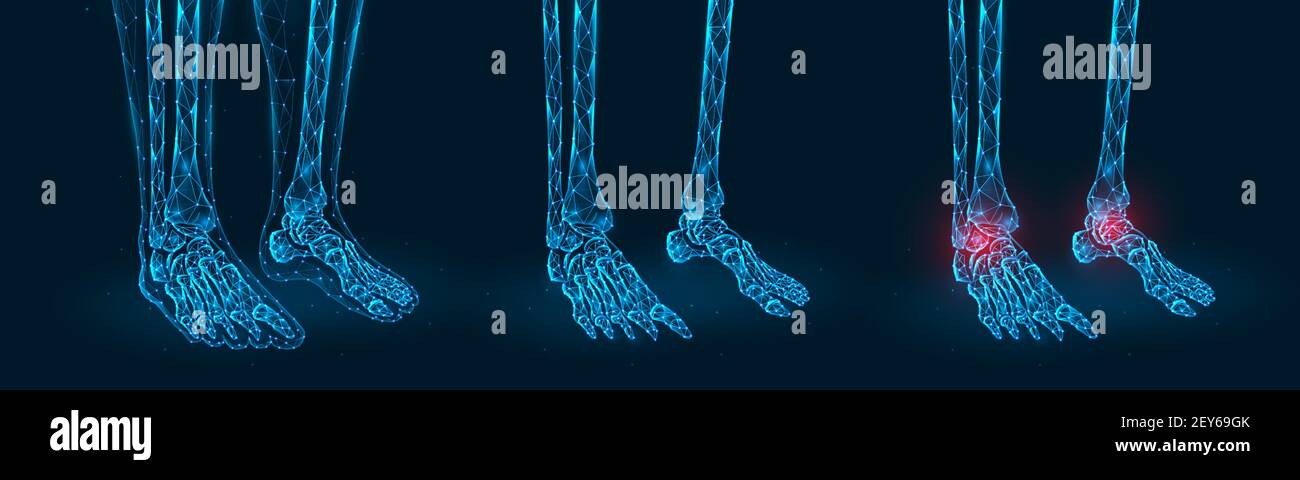 Douleur, blessure ou inflammation de l'articulation de la cheville illustration du vecteur polygonal. Modèle poly bas des pieds humains. Illustration de Vecteur