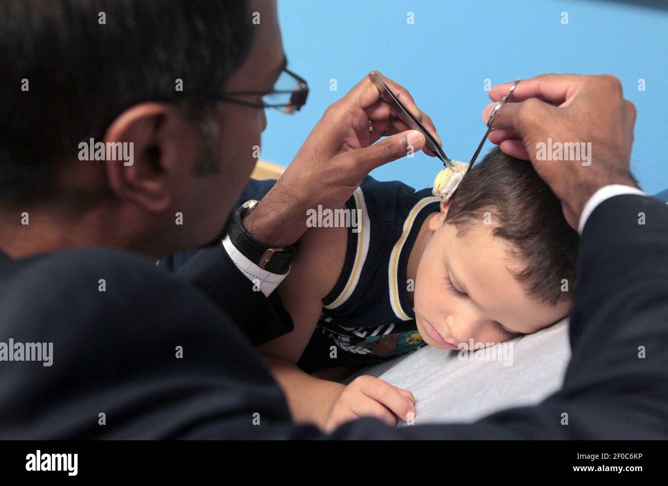 Le Dr Ananth Murthy, à gauche, enlève le dernier des bandages de la ...