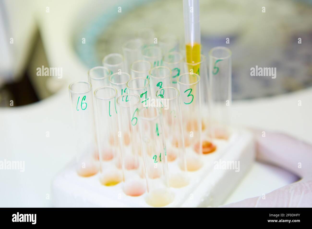 Pipeter l'échantillon dans un tube à essai, résumé des connaissances scientifiques Banque D'Images