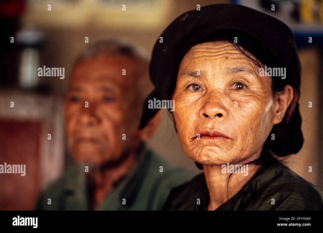 Une femme de village avec des taches de noix de coléoptère, au sud du Vietnam. Banque D'Images