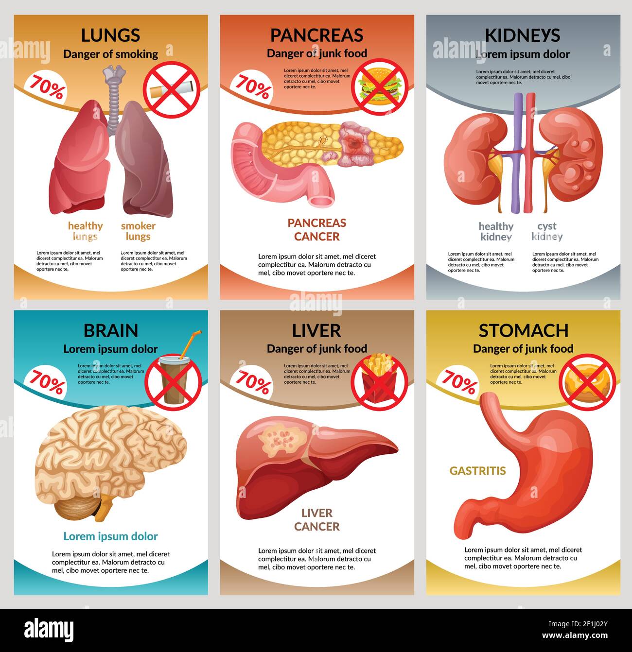 Modèle d'infographie scientifique sur les soins de santé avec différentes habitudes nuisibles conduisant à maladies des organes humains internes illustration du vecteur Illustration de Vecteur