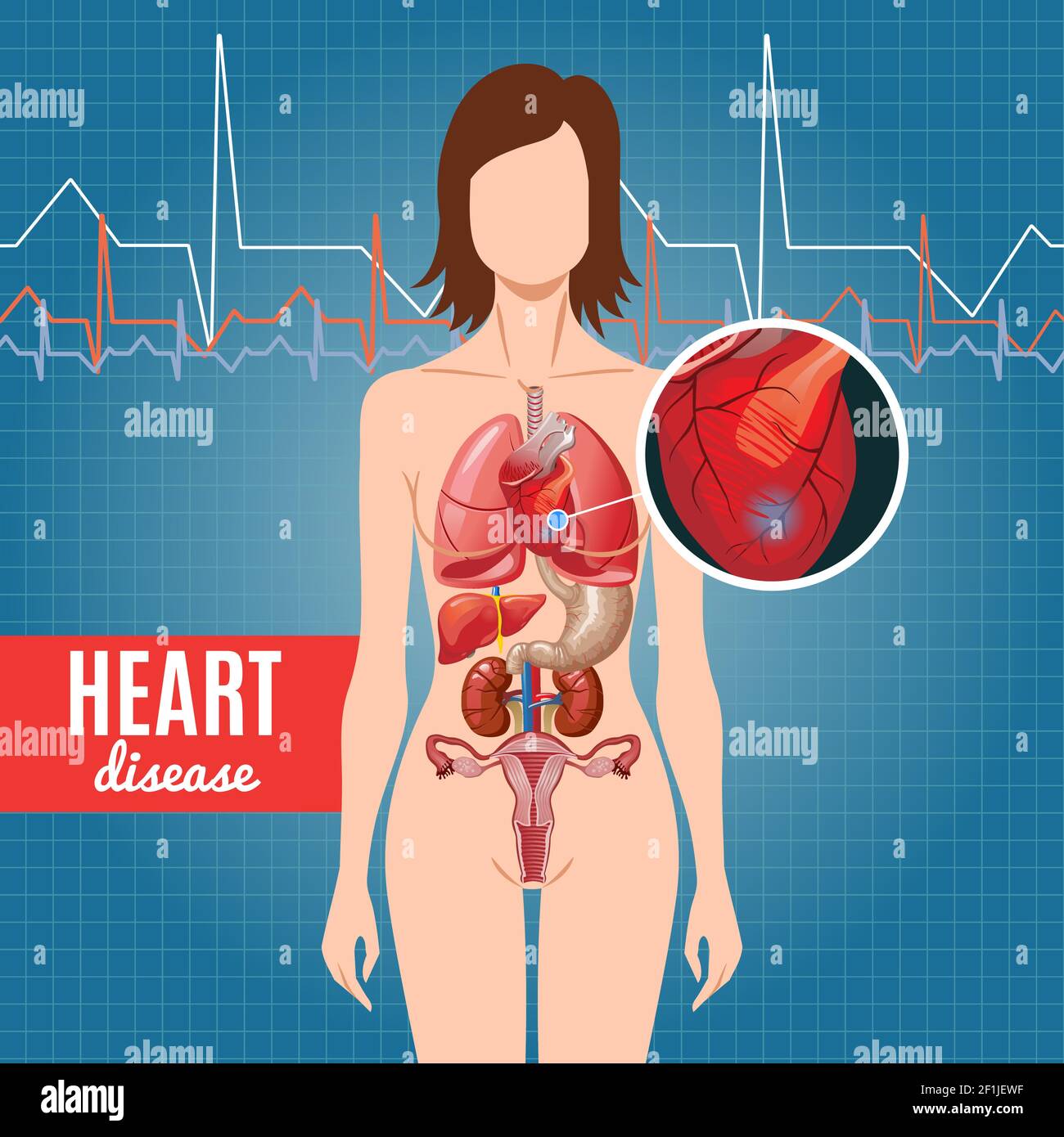 Affiche de la maladie de coeur de dessin animé avec des parties de l'anatomie humaine et interne illustration du vecteur d'arrière-plan des organes sur le battement de cœur Illustration de Vecteur