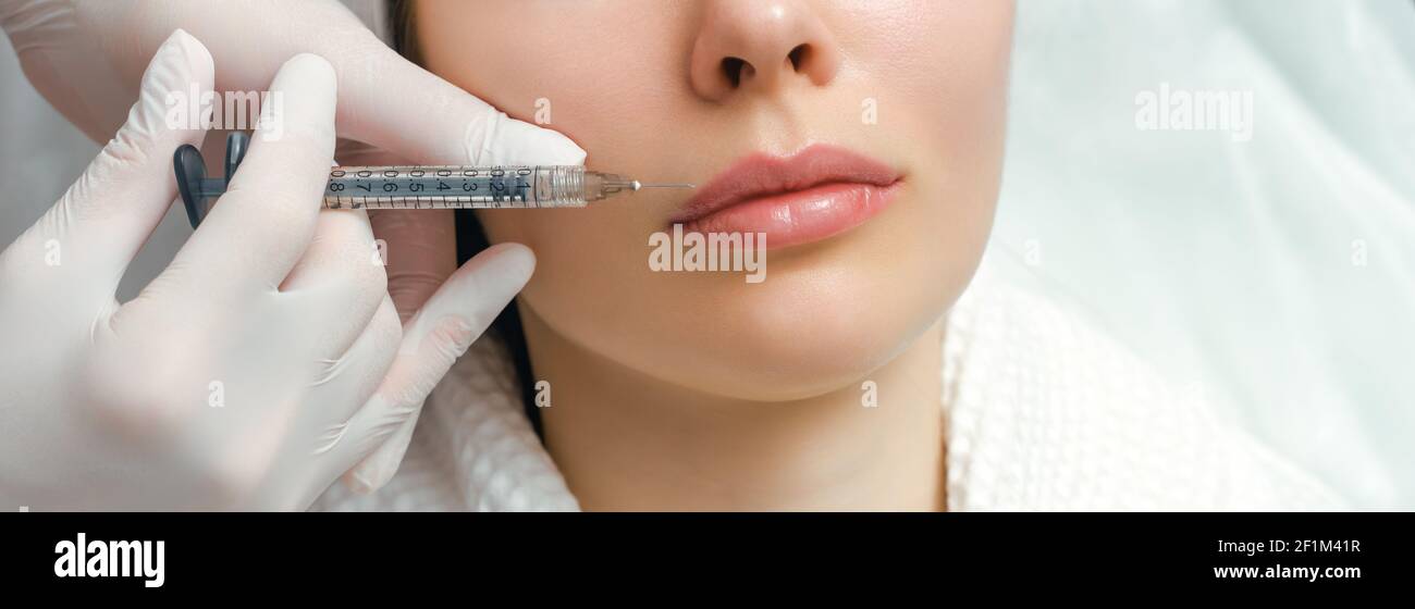 Procédure d'augmentation et de correction des lèvres dans un salon de cosmétologie. Le spécialiste effectue une injection dans les lèvres du patient. Banque D'Images