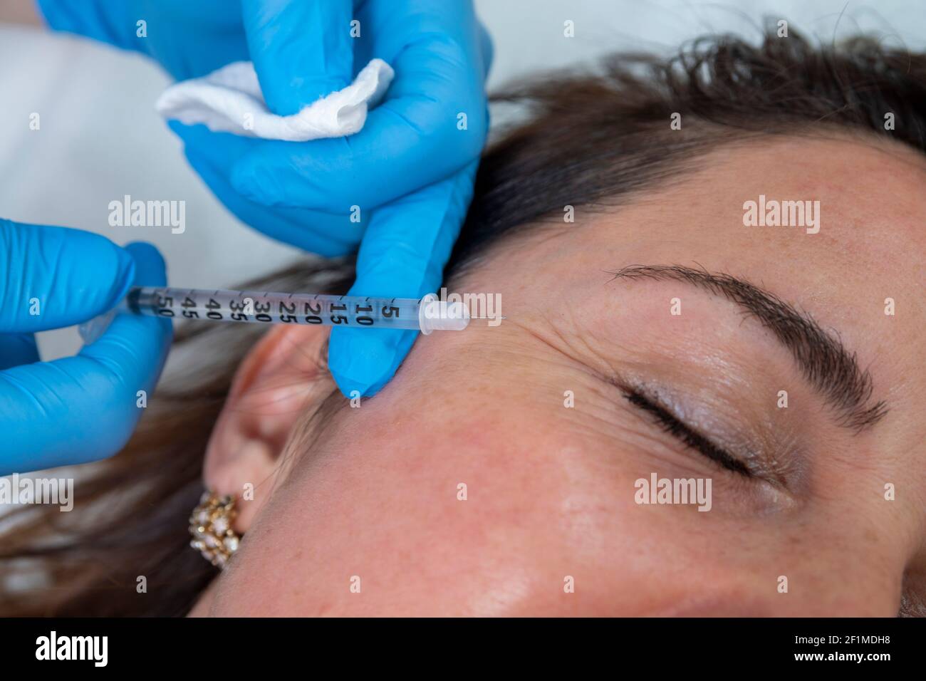 Traitement du visage antivieillissement et rajeunissant concept : un expert dermatologique injecte un traitement anti-rides liquide. Traitement professionnel pour femme de milieu d'âge. Banque D'Images