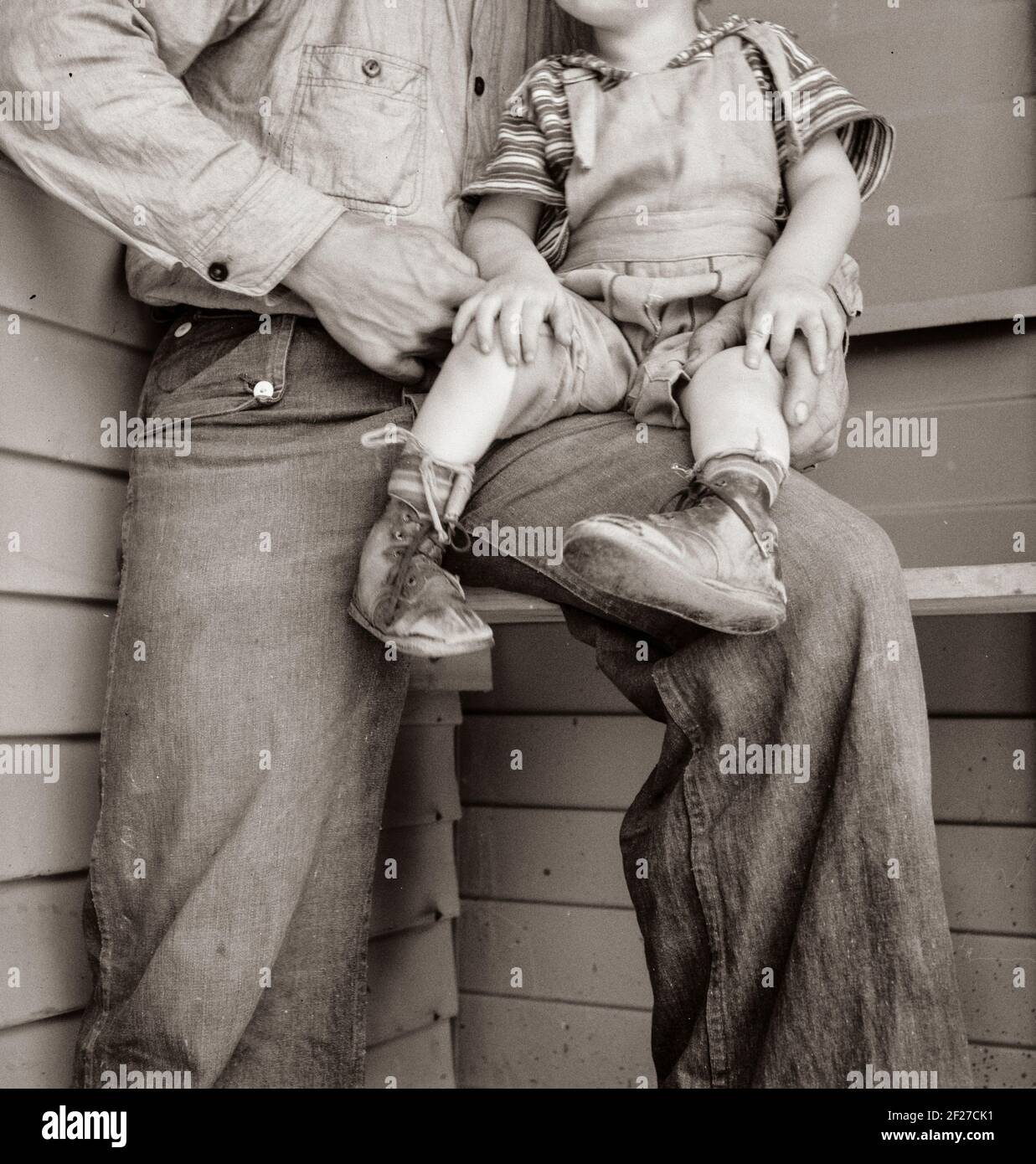 Tulare County. Dans le camp de l'Administration de la sécurité agricole (FSA) pour les travailleurs migrants. Bébé avec les pieds de club portant des attelles faites maison à l'intérieur des chaussures . Mai 1939. Photo de Dorothea Lange Banque D'Images