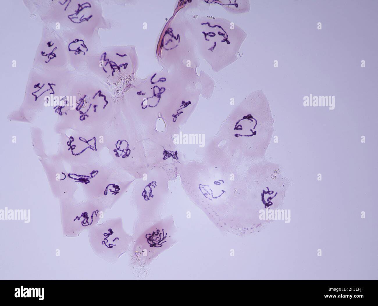 Chromosomes géants de la glande salivaire à un grossissement de 10 fois sous un microscope léger Banque D'Images