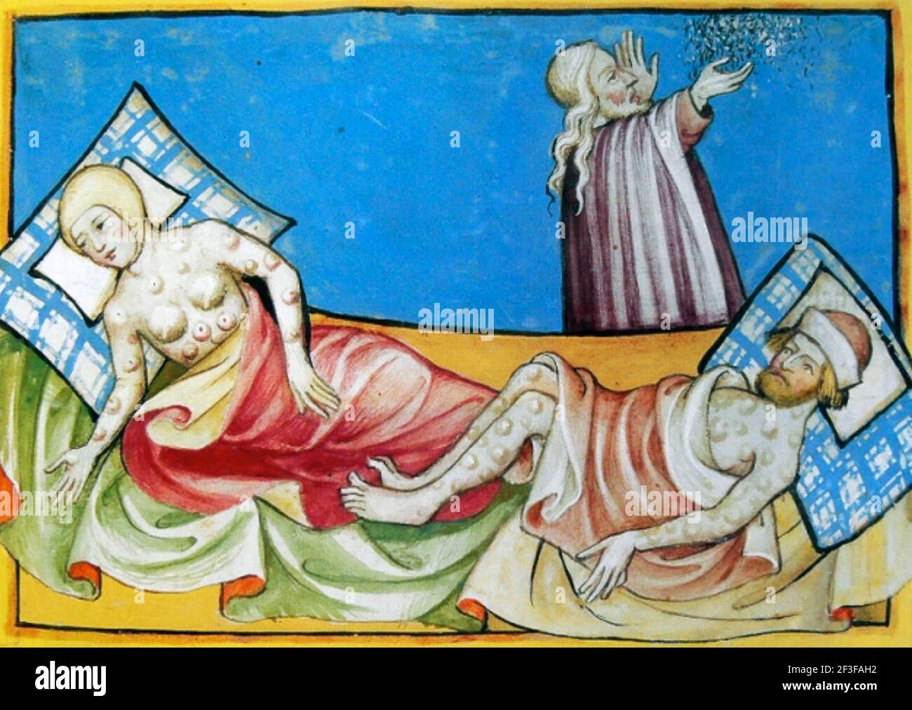 LA MORT NOIRE illustration médiévale de personnes souffrant de ganglions lymphatiques enflés, un signe de peste bubonique. Banque D'Images