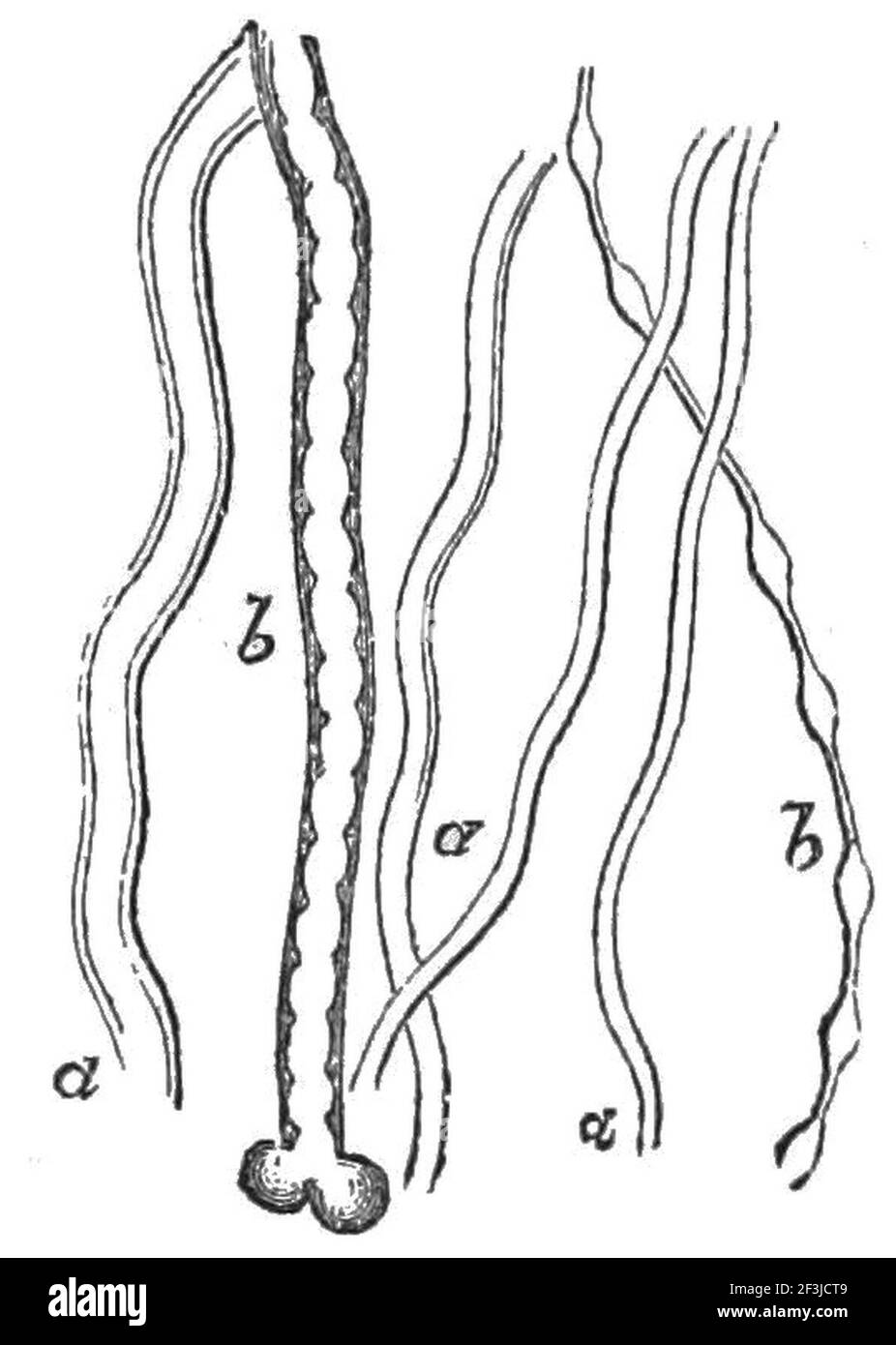 Fibres nerveuses humaines de différentes tailles. Banque D'Images